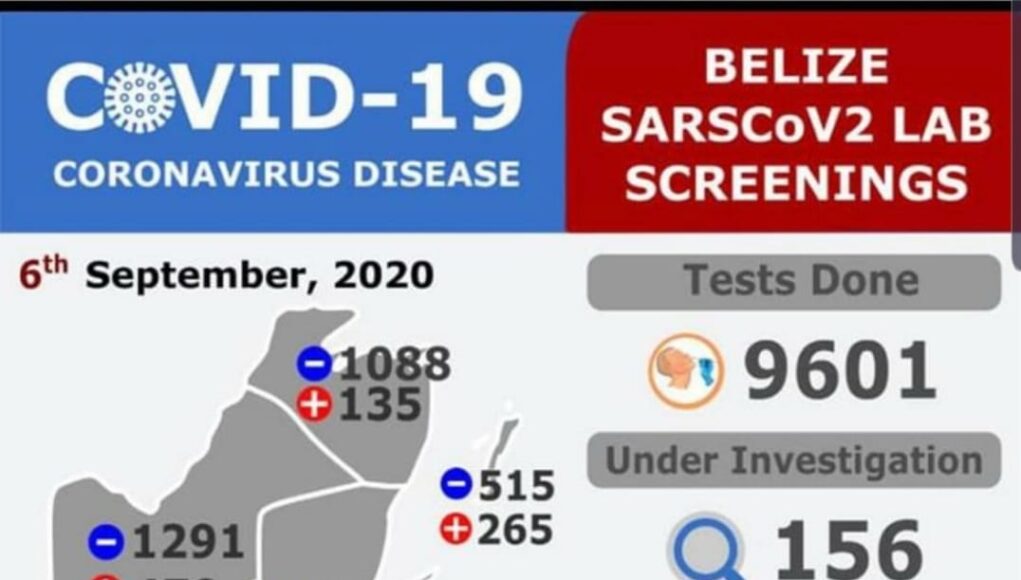 67 new COVID-19 cases confirmed 09-06-2020